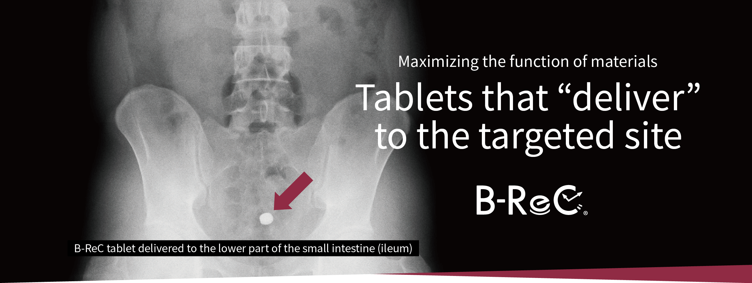 B-ReC tablet delivered to the lower part of the small intestine (ileum)/ Maximizing the function of materials Tablets that &ldquo;deliver&rdquo; to the targeted site B-ReC